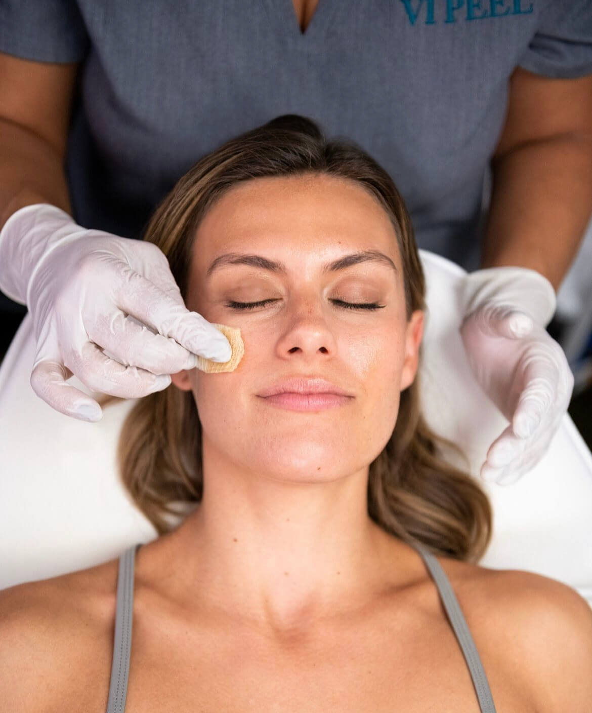 How Do Chemical Peels Work on Your Skin?