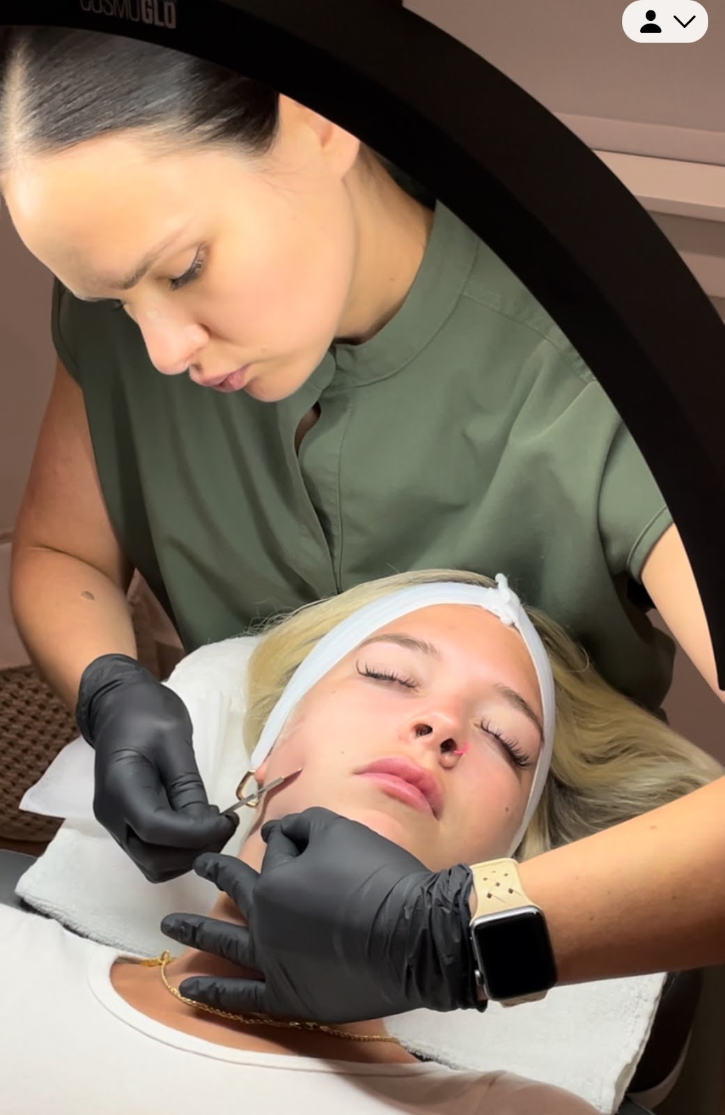 How Often Should You Dermaplane Renu Well Aesthetics And Wellness